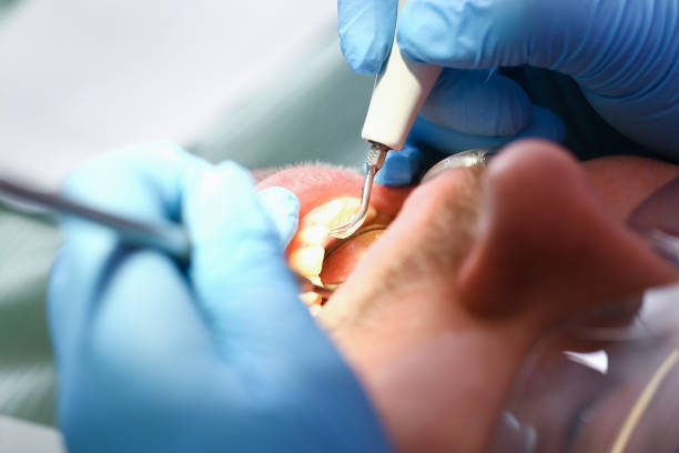 Best Emergency Treatment for Toothache in New Middletown, OH
